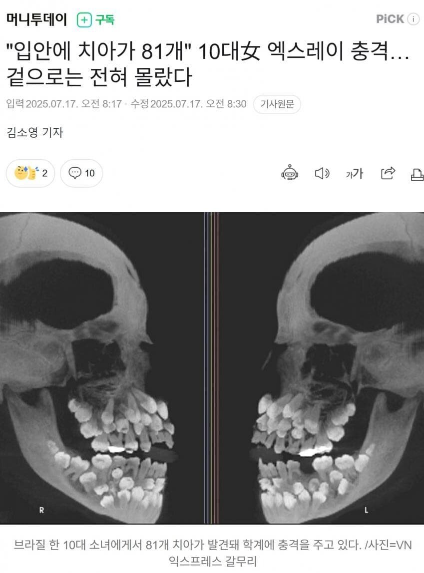 20250718211658_iCQepKTSO4.jpg?v=7