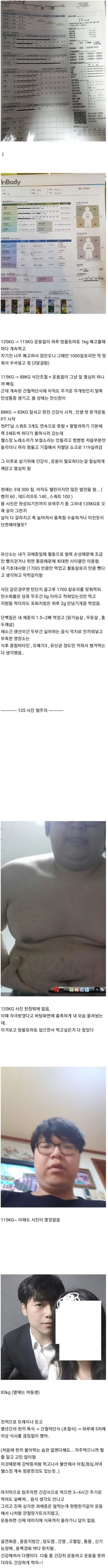20250730120006_YF2gGjt3LR.jpeg?v=7
